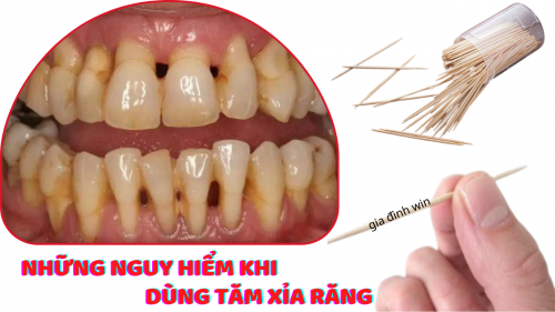 Tác hại khôn lường của thói quen dùng tăm xỉa răng sau khi ăn của người Việt